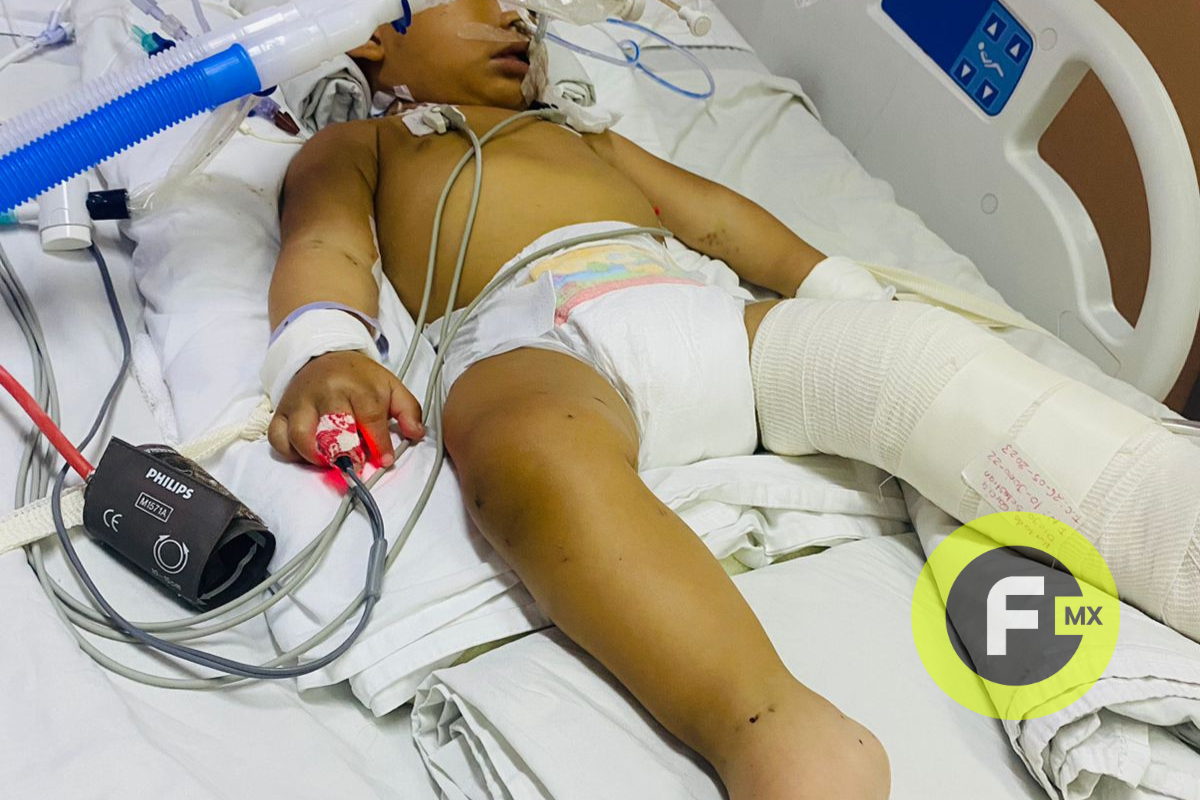 Diego, víctima de accidente en la autopista del Sol, lucha por sobrevivir