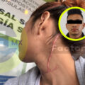 Sobrevivió a intento de feminicidio en Toluca; exige justicia